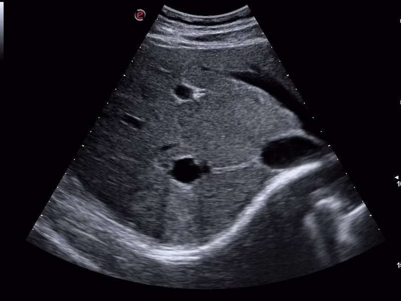 Abdomen echografie hond en kat