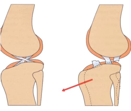 Gescheurde kruisband hond illustratie